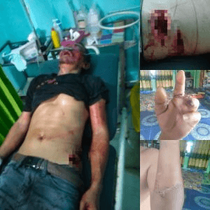 Pelapor Kini Jadi Tersangka, Ada Laporan Tandingan Dalam Kasus Korban Jadi Tersangka,