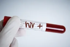 Makassar Catat 454 Kasus Baru HIV/AIDS 2025, Transmisi Seksual Masih Dominan