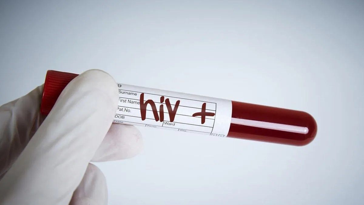 Makassar Catat 454 Kasus Baru HIV/AIDS 2025, Transmisi Seksual Masih Dominan