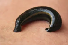 Mimisan Hampir 10 Hari, Lintah Ditemukan Bersarang di Hidung Pria di China