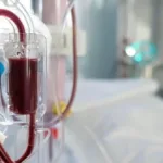 Mengenal Cuci Darah: Prosedur dan Manfaat Dialisis bagi Pasien Gagal Ginjal